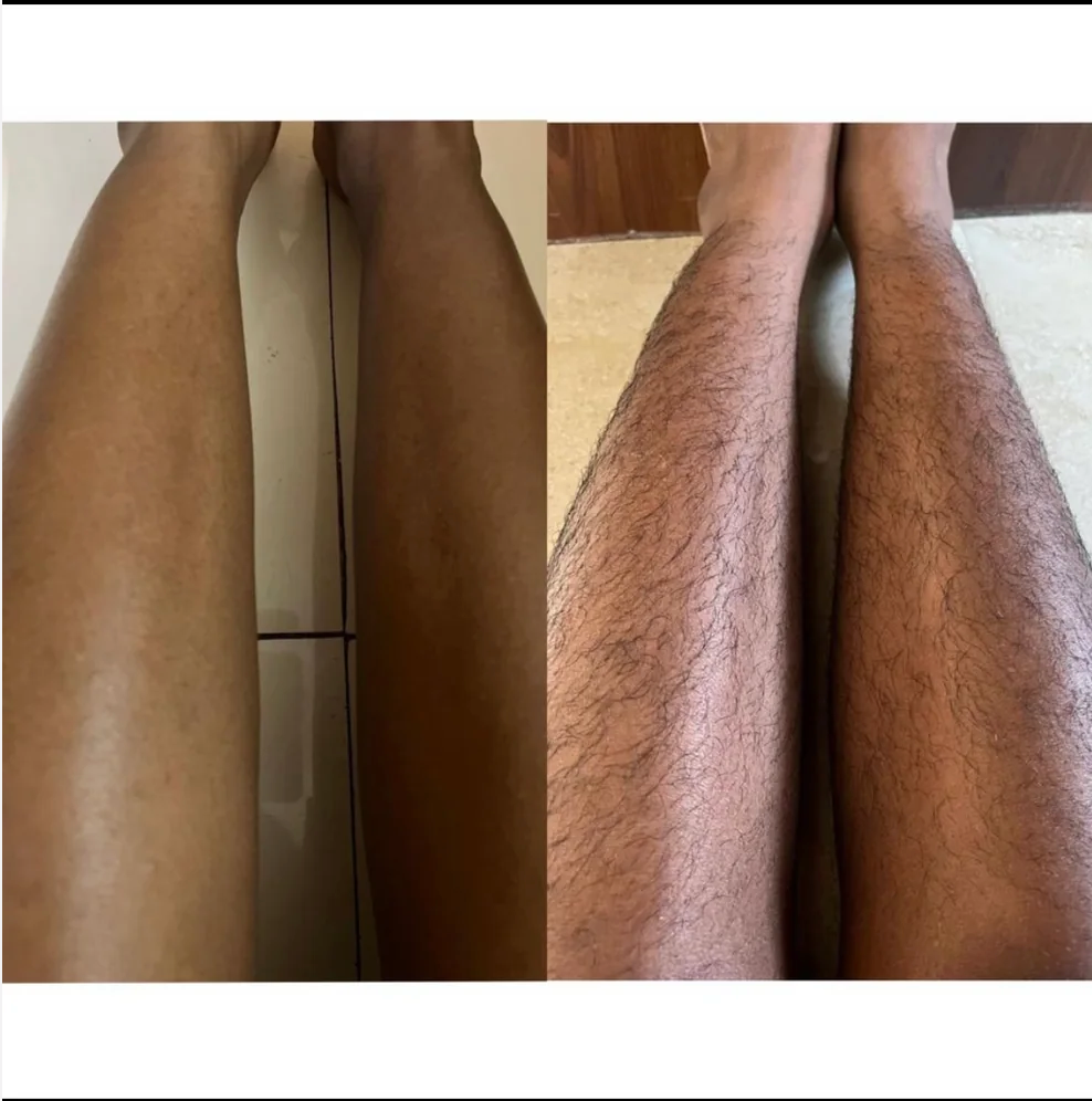 Hair removal powder(Wax powder)